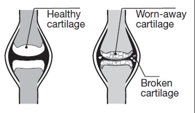 cartilage - cartilage
