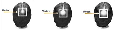 Vertex Image - image 01
