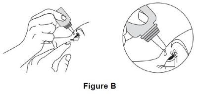 Fig-b (Fig B)