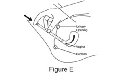 Figure-e (Figure E)