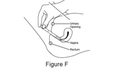 Figure-f (Figure F)