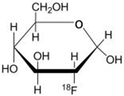Chemical Structure Of Fludeoxyglucose F 18 (Fludeoxyglucose F 18 Injection Usp 01)