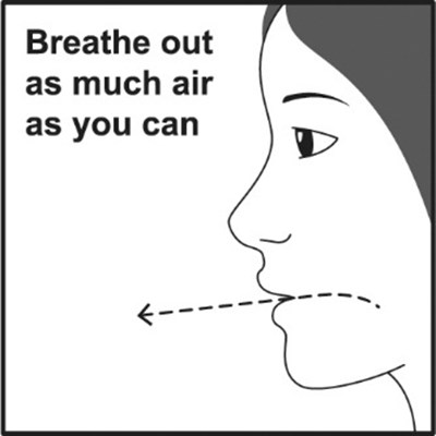 Figure F (Albuterolhfa Spl Graphic 09)