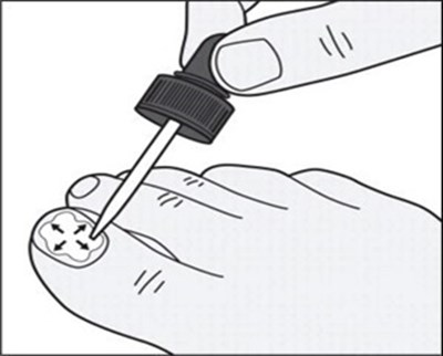 Figure-d.jpg (Figure D)