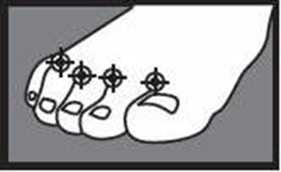 image - terbinafine 01