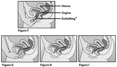 Image Description (Enilloring Figure 9)