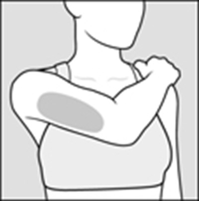 figure_c_arms - glatopa image 07