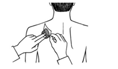 exelon-patch-0A.jpg Press the patch firmly in place with the hand to make sure that the edges stick well. - exelon patch 0A