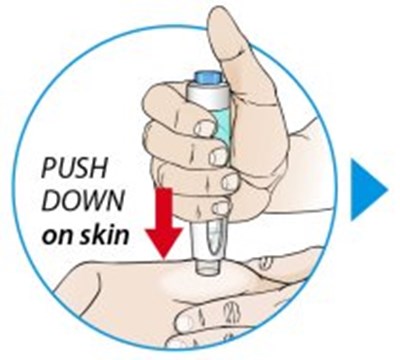 Autoinjector push down - orencia ai pushdown