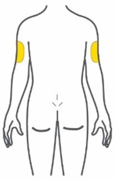 Figure (Trulicity Ifu 0point75 Injection Sites Back V1)