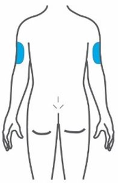 Figure (Trulicity Ifu 1point5 Injection Sites Back V1)