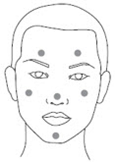 Figure 2 (Clindamycin 04)