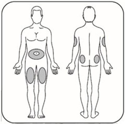 basaglar-inj-sites.jpg Figure - basaglar inj sites