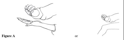 Figure A (Figurea)