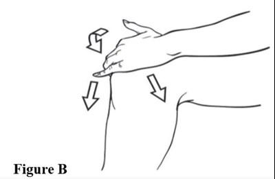 Figure B (Figureb)
