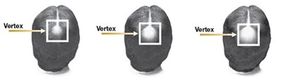 Vertex (Vertex)