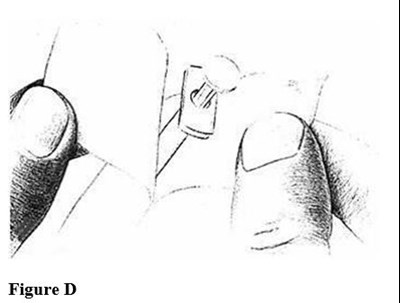 Figured (Figd)