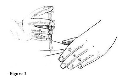 Figurej (Figj)