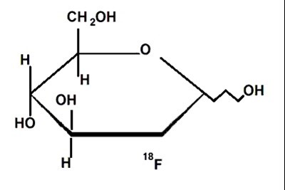 Fludeoxyglucose F-18 (Fdg)