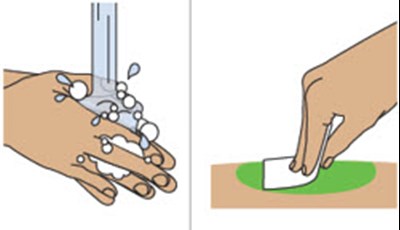 Figure 13 (Tryngolza 13)