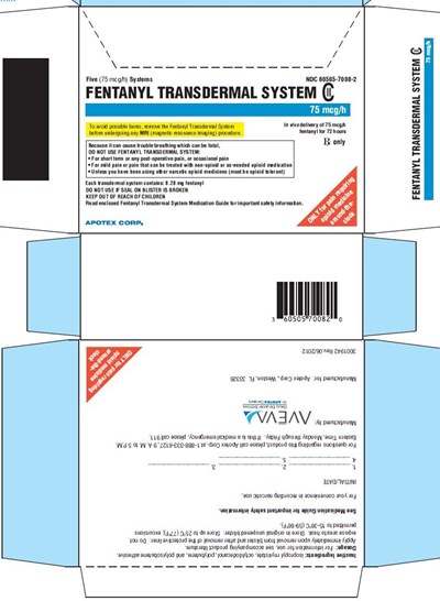 75mcg-hr-Carton.jpg 75mcg-hr-Carton - 75mcg hr Carton