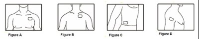 Instruction-figureA-D.jpg - Instruction figureA D