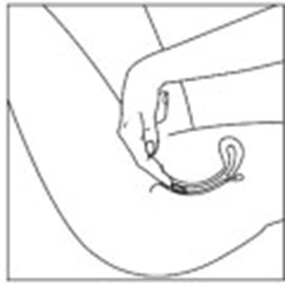 imv00-0004-05.jpg Figure - imv00 0004 05