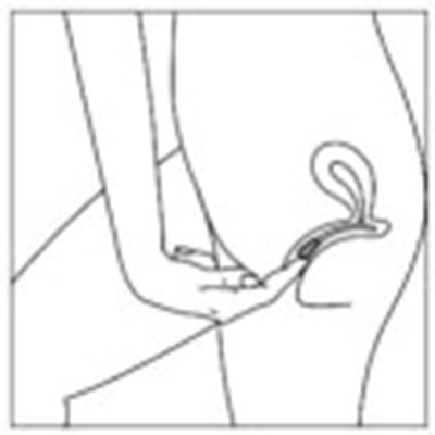 imv00-0004-06.jpg Figure - imv00 0004 06