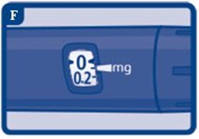 Step 3 - Fig. J - image 15