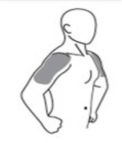 Andro Shoulders Side View (Side)