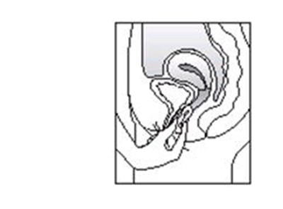 Figure (Estring 05)
