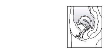 Figure (Estring 06)