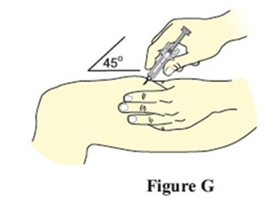 Figure G (Image 11)