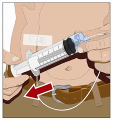 Figure 11 (Gammagard0011)