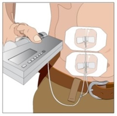 Figure 12 (Gammagard0012)