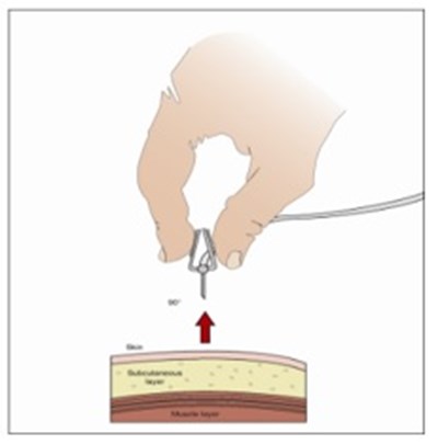 Figure 13 (Gammagard0013)