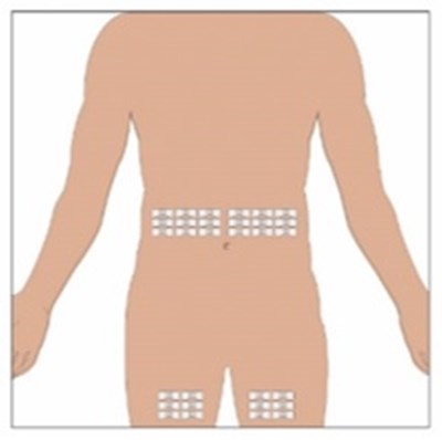 Figure 5 (Gammagard5)