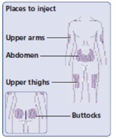 Figure I: Injection Sites (Image 26)