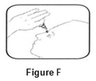 Instructions For Use (Figure F)