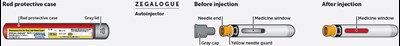 dasiglucagon-17.jpg AI-description.jpg - dasiglucagon 17