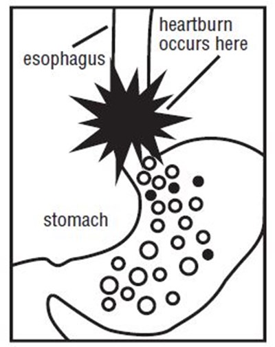 Ran-150mg-otc-esophagus (Ranitidine 150 mg 60 Tabs For Apotex 1)
