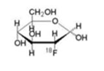 Fludeoxyglucose F 18 Injection Usp Is Provided As A Ready To Use Sterile, Pyrogen Free, Clear, Colorless Citrate Buffered Solution. Each mL Contains Between 0.740 To 8.88 Gbq (20.0­240 Mci) Of 2-deoxy-2-[18f]fluoro-d-glucose At The Eos, 4.5 mg Of Sodium Chloride In Citrate Buffer. The Ph Of The Solution Is Between 4.5 And 7.5. The Solution Is Packaged In A Multiple-dose Glass Vial And Does Not Contain Any Preservative. Ethanol (3 mg/ml) Is Used As An Antioxidant In Fludeoxyglucose F 18 Injection Usp. (Fludeoxyglucose F 18 Injection 01)