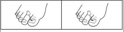 Fig 2 (Fig 2)