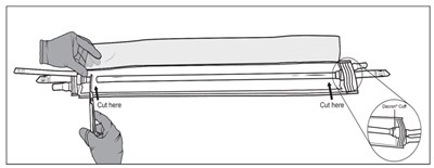 Figure M (Symvess 13)