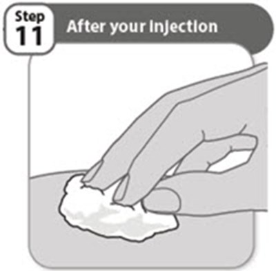 Step 11 (Abrilada 14)