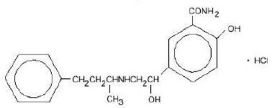 Labetalol Hydrochloride Structural Formula (0ddb0de2 08a1 4d9e 960d 88425cfa564d 01)