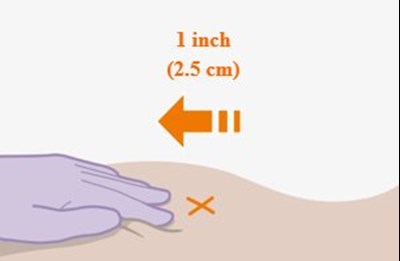 Figure O (Cabenuva Spl Graphic 19)