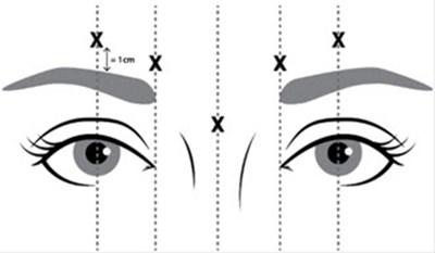 Figure 1-2 (Image 01)