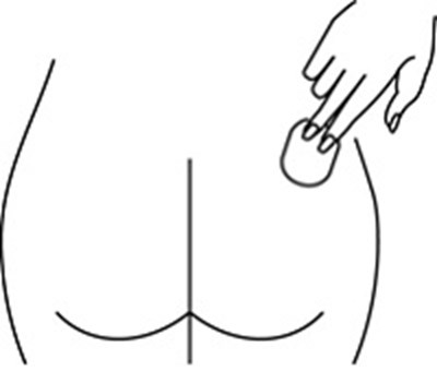 Fig G.jpg (Image 13)