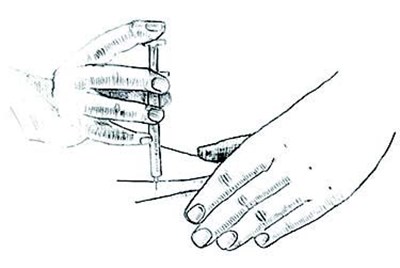 Lueprolide Injection (Figure J)